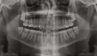 The Surreal Visions of Hernan Diaz Alonso/HDA-X