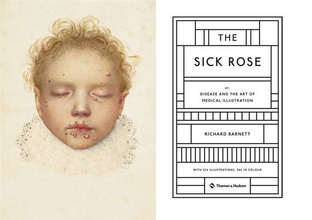The Sick Rose Or; Disease and the Art 