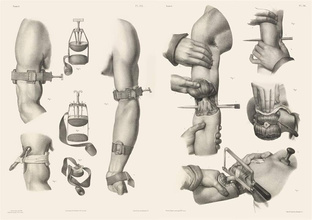 Crucial Interventions : Nineteenth Century Surgery