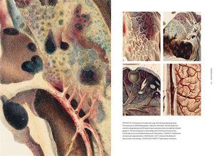 The Sick Rose Or; Disease and the Art 