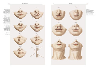 Crucial Interventions : Nineteenth Century Surgery
