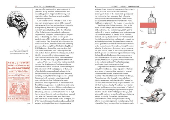 Crucial Interventions : Nineteenth Century Surgery