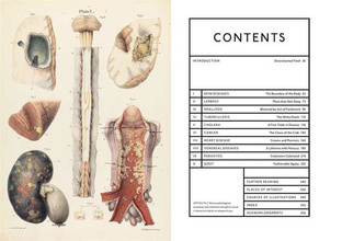 The Sick Rose Or; Disease and the Art 