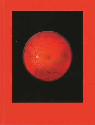 Mikhael Subotzky: Retinal Shift