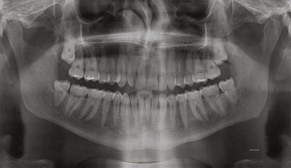 The Surreal Visions of Hernan Diaz Alonso/HDA-X