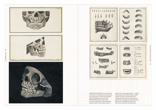 The Smile Stealers. Art of Dentistry