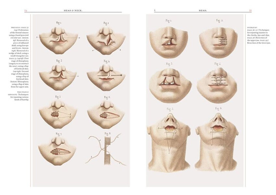 Crucial Interventions : Nineteenth Century Surgery