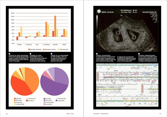 Twinkind : The singular significance of twins