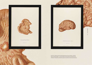 The Sick Rose Or; Disease and the Art 