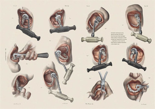 The Smile Stealers. Art of Dentistry