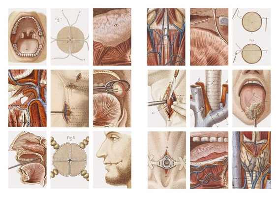 Crucial Interventions : Nineteenth Century Surgery