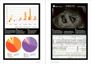 Twinkind : The singular significance of twins